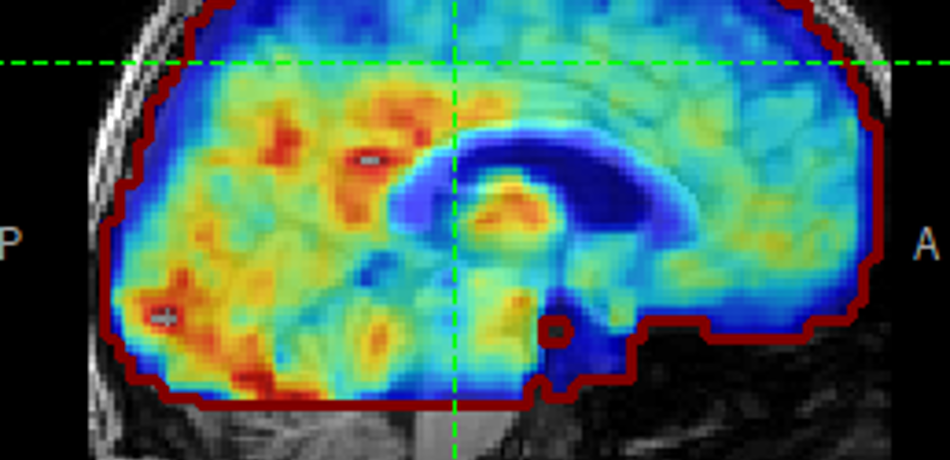 Brain ultrasound image