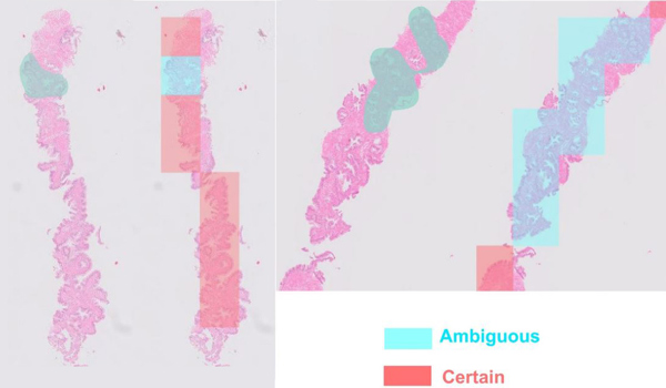 AI Pathology Image