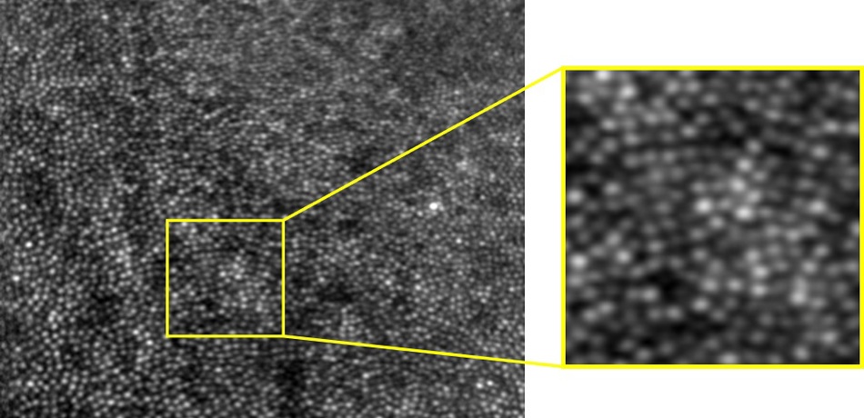 Image of the perifoveal region of the living human retina captured from the Oxford adaptive optics scanning laser ophthalmoscope (AOSLO) built by Dr Jiahe Cui